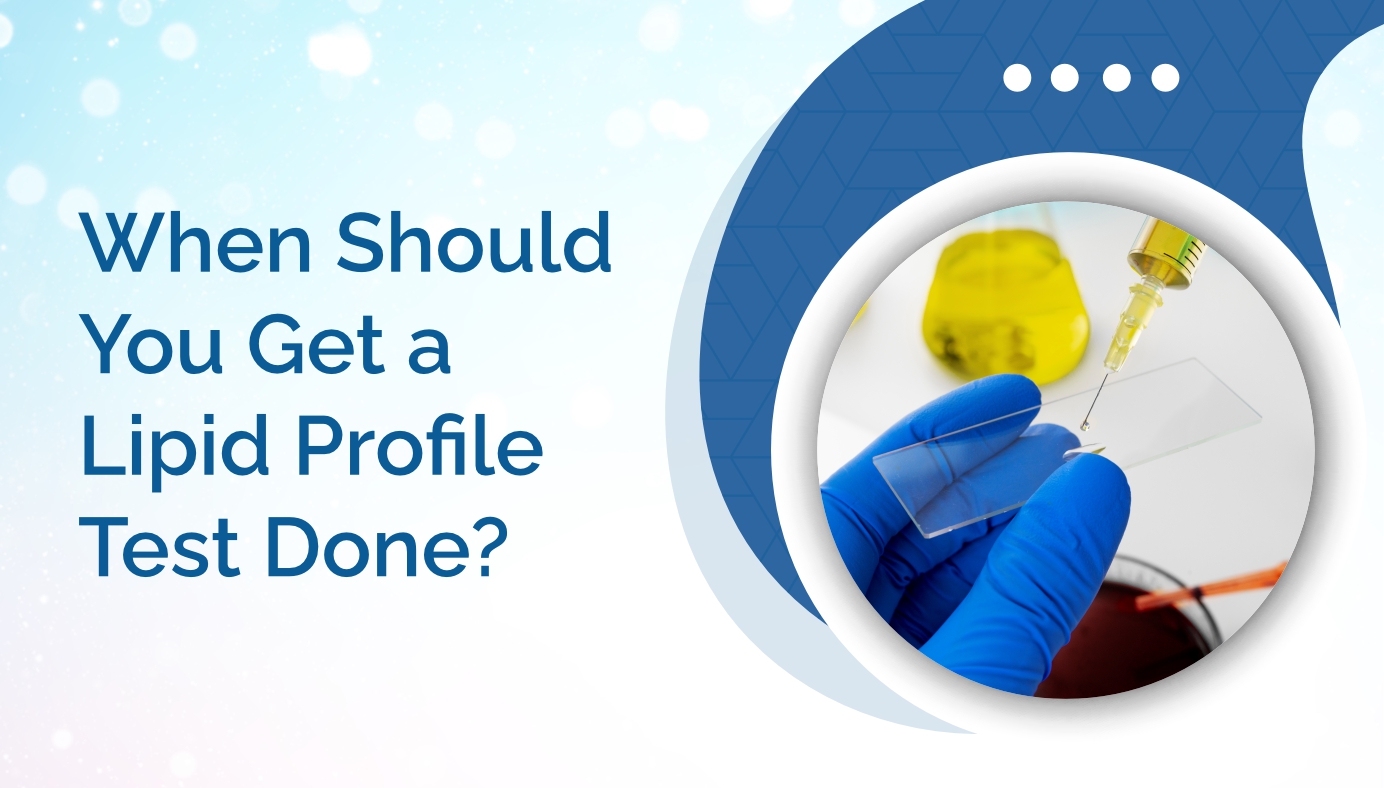 Fasting vs Non-Fasting Lipid Profile – Which is Better?